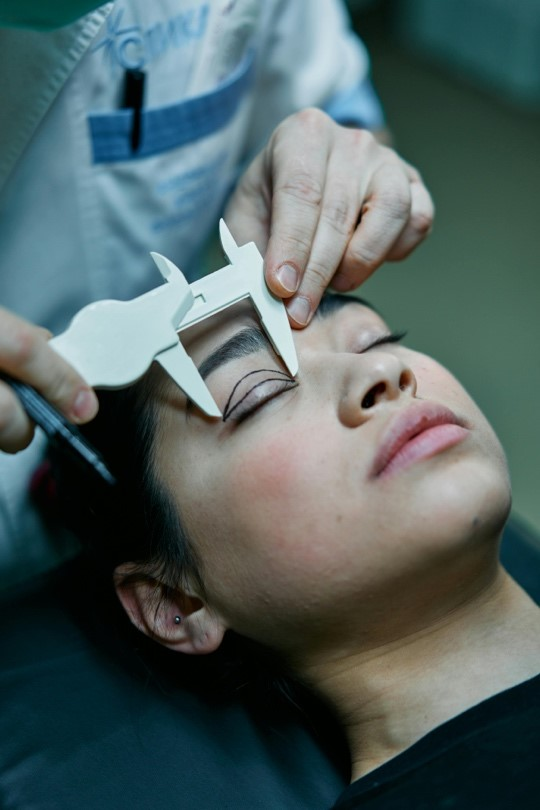 Eyelid Surgery or Blepharoplasty Benefit